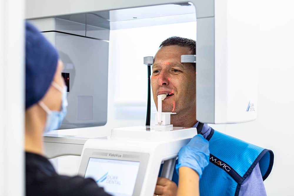CT-digitalna stomatologija